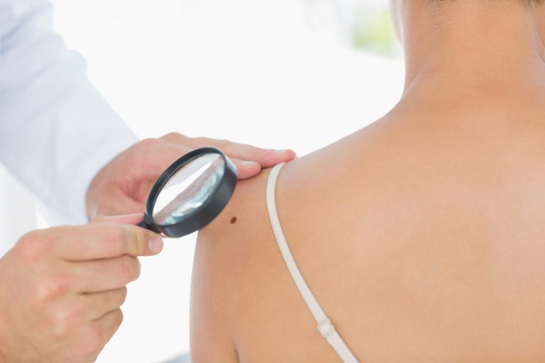 Dermatologista utiliza lupa para analisar pele de paciente