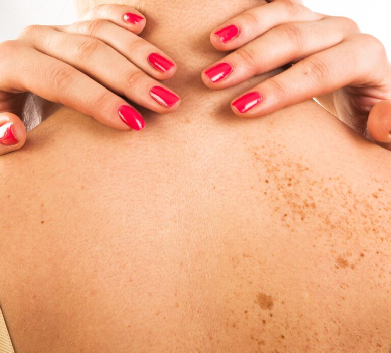 Mulher com mãos na parte de trás do pescoço