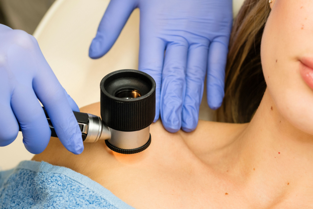 Dermatoscopia: como funciona e quando é indicada?