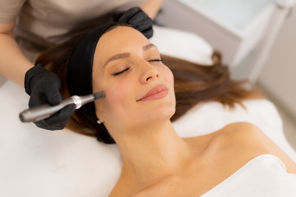 Microagulhamento facial: benefícios, como funciona e resultados esperados