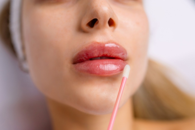 Cuidados após preenchimento labial