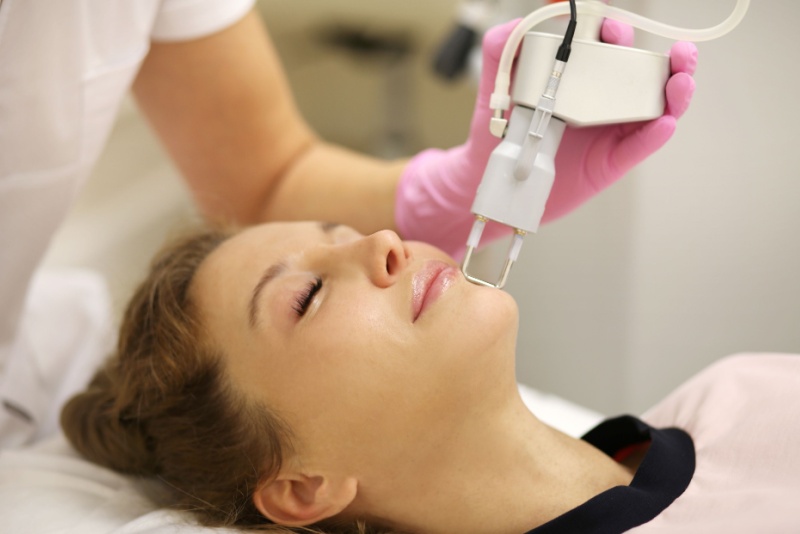 Laser para melasma: como funciona, tipos e resultados