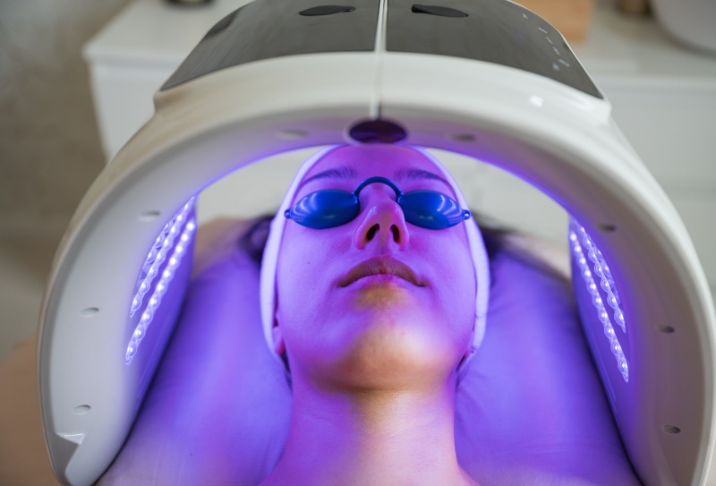 Laserterapia para rejuvenescimento facial